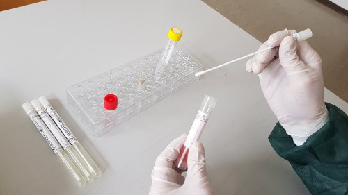 Test auf SARS-CoV-2: Ein Nasen- und Rachenabstrich wird entnommen und anschließend zur Auswertung in ein Labor übersandt. (Foto: OBK)