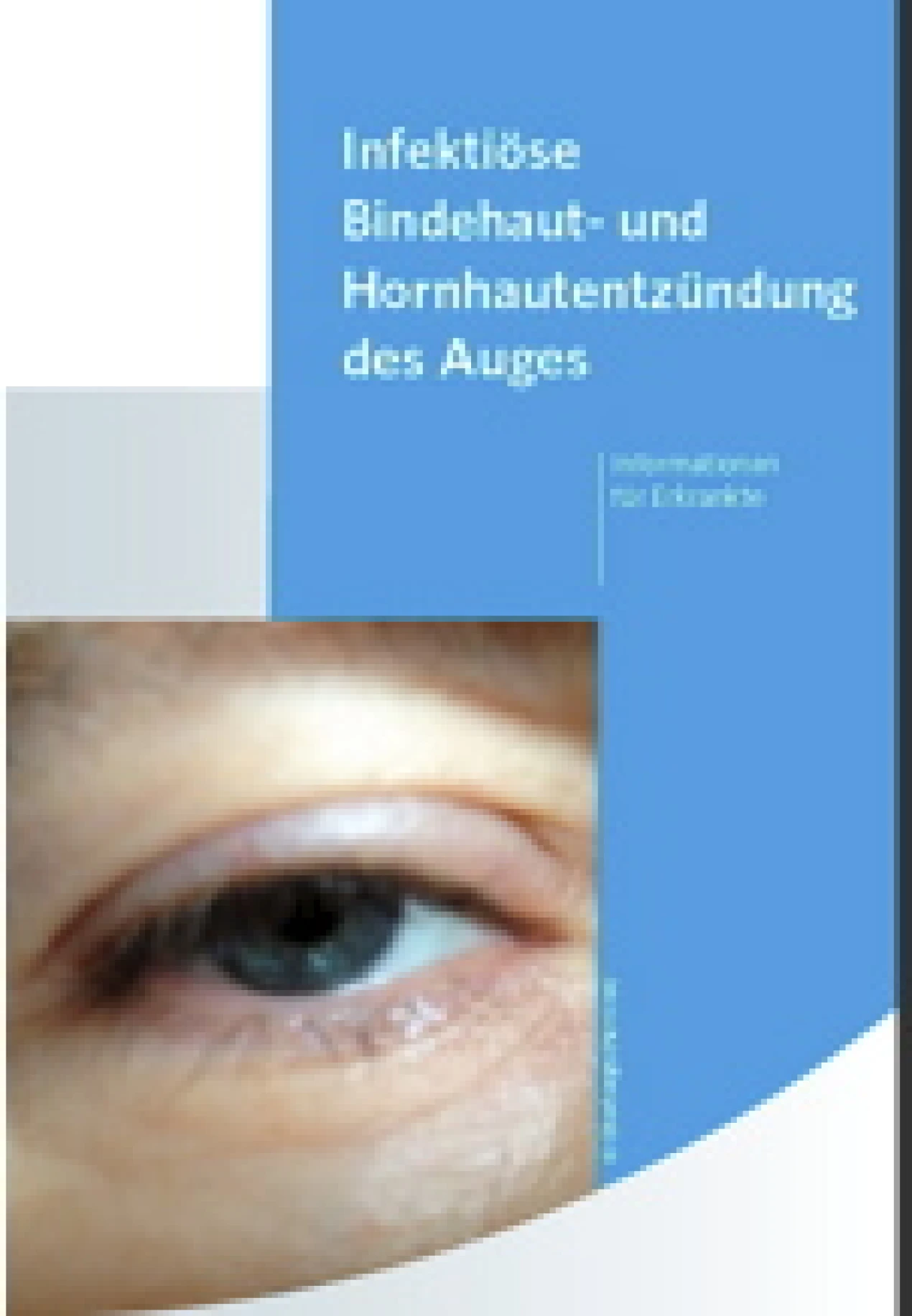 Titel des Merkblattes Bindehautentzündung (Foto:OBK)